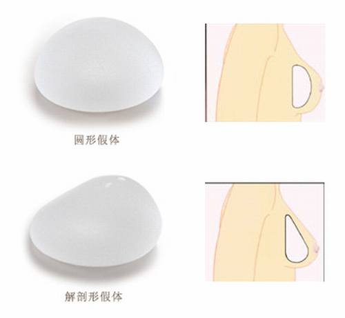 北京八大处刘春军做假体隆胸怎么样?有案例吗?