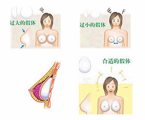 北京八大处刘春军做假体隆胸怎么样?有案例吗?