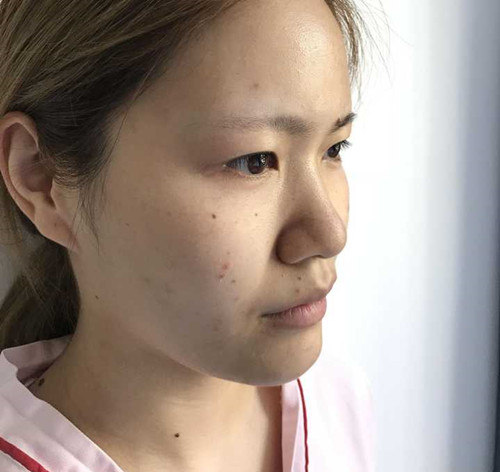 花了4万多在北京做的鼻部手术和眼部手术。