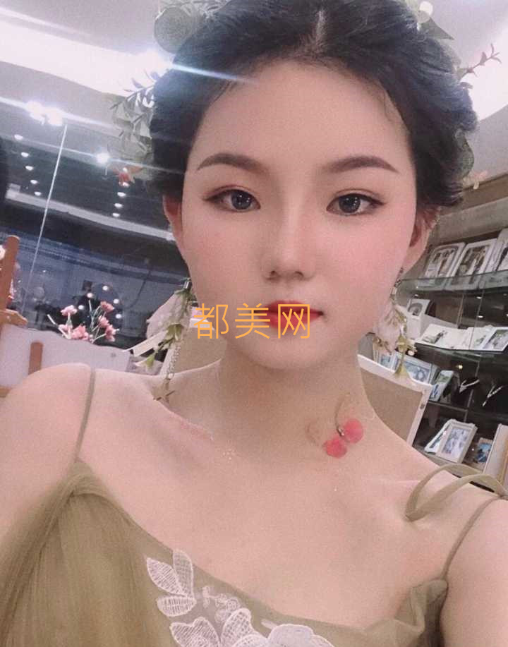 分享我在郑州做的隆鼻,不说惊艳但是也很好看了!