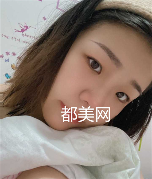 重庆隆鼻没有做缩小鼻翼也很好看,妈生鼻。